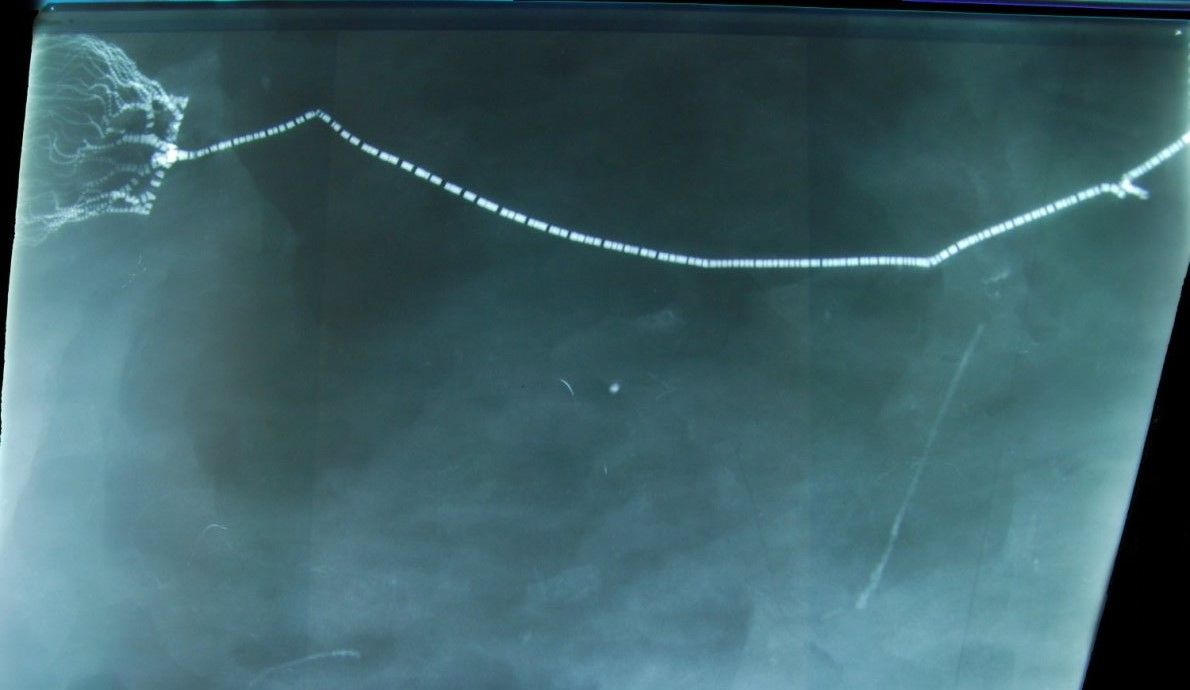 Bundenbach_Taxocrinus xray Bundenbach_Taxocrinus_xray