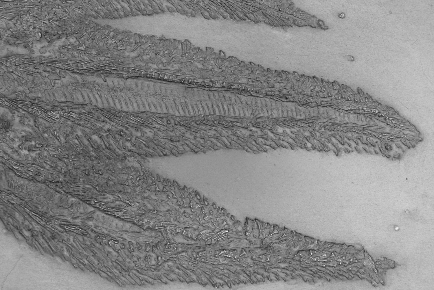 Jaekelaster_petaliformis_Bundenbach_Detail