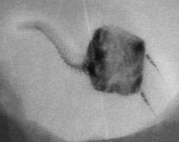 Rhenocystis x-ray Rhenocystis_x-ray